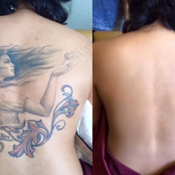 tattoo-cover-up